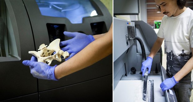Novou kost nechal doktor Herrand vytvořit na 3D tiskárně.