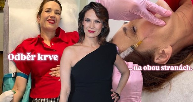 Tereza Kostková na plazmaterapiii