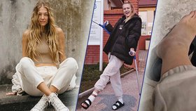 Miss Natálie Kotková: Bolestivé zranění, ohromná modřina a berle!