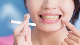 Co způsobuje žloutnutí zubů?