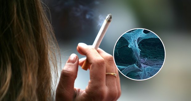 Kouření cigaret si většina lidí spojuje s rakovinou plic nebo srdečním infarktem. Málokdo ale ví, že toxické zplodiny hoření doslova rozežírají lidskou kostru zevnitř.
