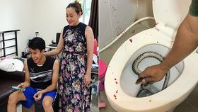 Mladík močil vsedě na záchodě: Číhající had se mu zakousl rovnou do penisu!