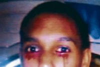 Patnáctiletý chlapec pláče krev