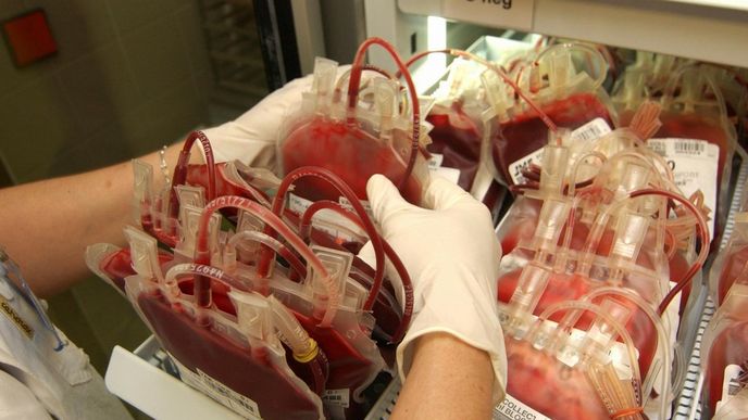 Krevní plazma se dosud získává výhradně od dárců. Zhruba sto milionů litrů tekutiny ročně zdravotníkům chybí.