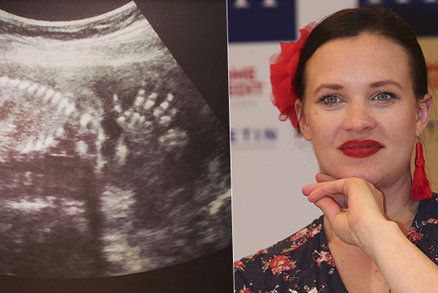 Kristýna Leichtová čeká druhé dítě! Rovnou se pochlubila snímkem z ultrazvuku