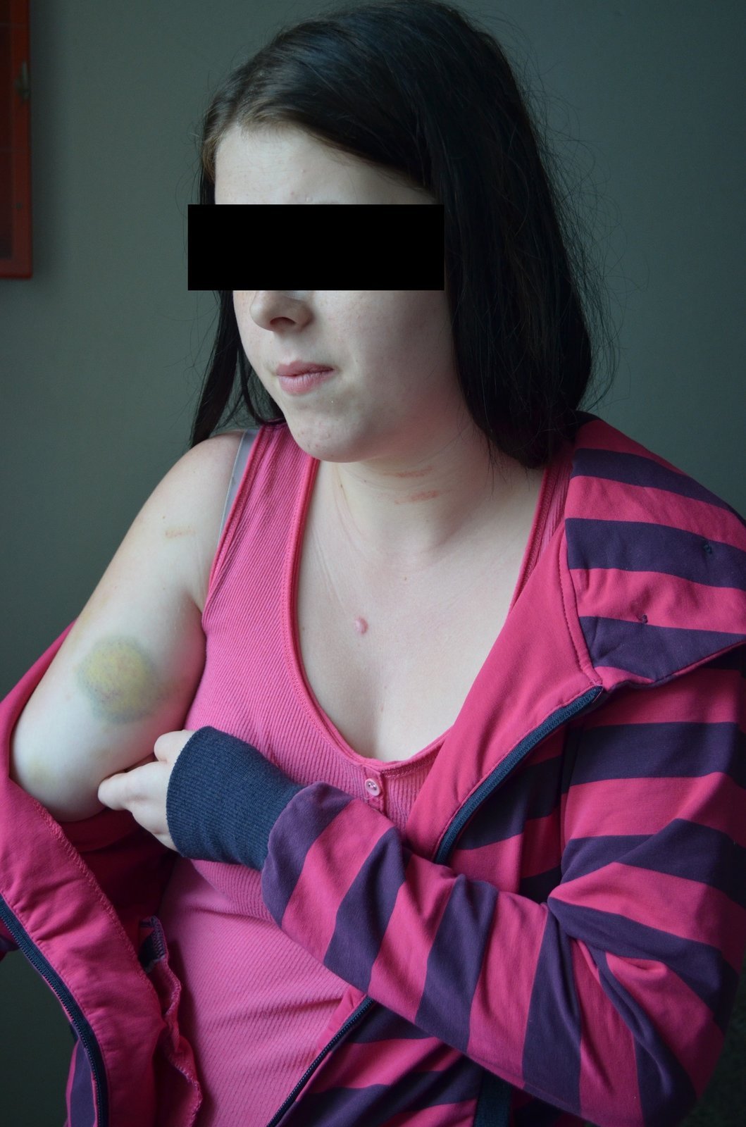 Kristýna O. je ve 3. měsíci těhotenství. Má pohmožděniny, škrábance a zlomené nosní kůstky.