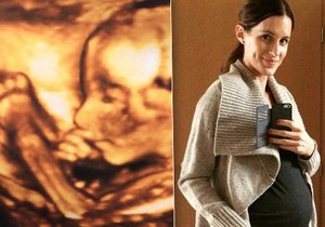 Lucie Křížková ukázala ultrazvuk svého miminka.