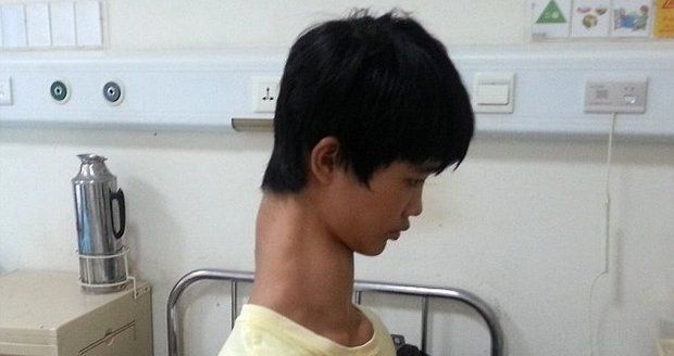 Žirafí kluk z Číny: Vypadá, jak kdyby ho někdo natáhl na skřipci