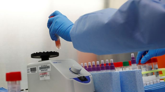 Testy na koronavirus probíhají ve spoustě zemí.