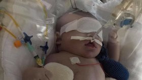 Dvouletého Kryštofa museli po porodu více než půl hodiny resuscitovat. Teď trpí nejtěžší formou dětské mozkové obrny.