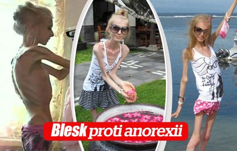 Šílené! Dívka má 20 kilo a radí, jak hubnout