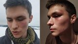 Drsný útok řidiče subaru na mladíka ve Dvoře Králové: Kurýr Honza (19) skončil s otřesem mozku