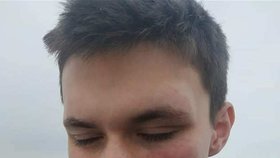 Drsný útok řidiče subaru na mladého kurýra ve Dvoře Králové: Honza (19) skončil s oteklým okem a otřesem mozku