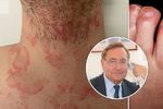 Některé nemoci se dají poznat z kůže, říká dermatolog