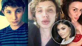 Mladík se pomocí plastik mění na Kylie Jenner.