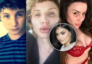 Mladík se pomocí plastik mění na Kylie Jenner.