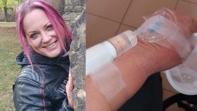 Šárka (39) se napila šťávy z kysaného zelí z obchodu: Dusila se, lékaři jí dávali deset minut