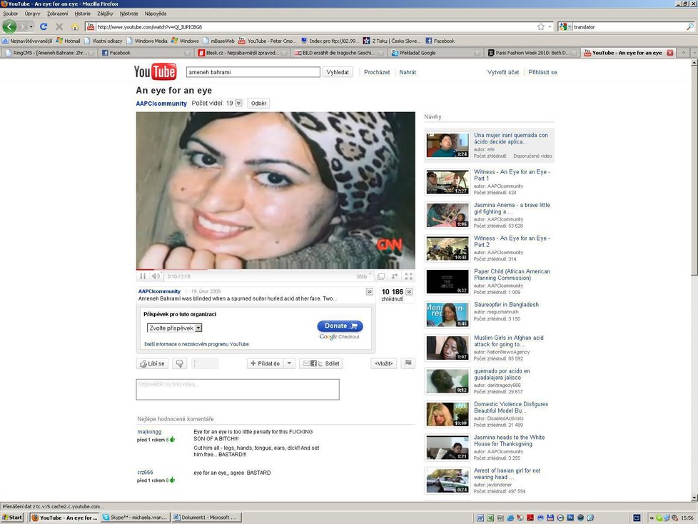 Takhle vypadala Ameneh Bahrami před kyselinovým útokem.
