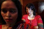 V Bangladéši se v předvečer Mezinárodního dne žen konala přehlídka, kde v roli modelek na mole vystoupily oběti kyselinových útoků