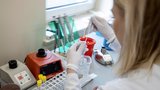 Na koronavirus se můžete nechat testovat sami. V jakých laboratořích a kolik to stojí?