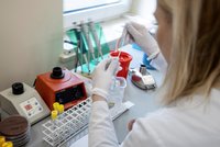 Na koronavirus se můžete nechat testovat sami. V jakých laboratořích a kolik to stojí?