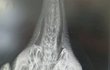 Rentgenový snímek háčku v krku labutě.