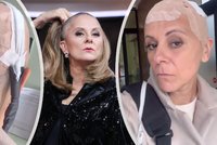Náročná léčba rakoviny Laďky Něrgešové (49): 18 hodin denně s helmou na hlavě!