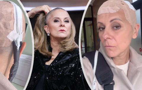 Laďka Něrgešová a náročná léčba: 18 hodin denně s helmou na hlavě | Blesk.cz