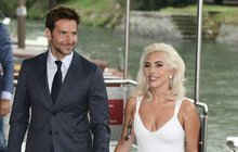 Lady Gaga po pádu z pódia: Nestydatá ledová koupel