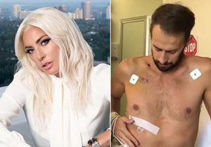 Postřelený venčitel pejsků Lady Gaga: Přišel o kus plíce!