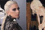 Lady Gaga přiznala, že denně trpí chronickými bolestmi.