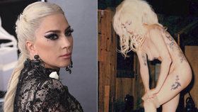 Lady Gaga přiznala, že denně trpí chronickými bolestmi.