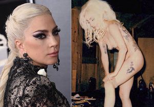 Lady Gaga přiznala, že denně trpí chronickými bolestmi.
