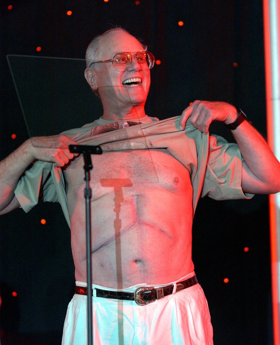 Larry ukazuje jizvu po transplantaci jater v roce 2004.