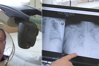Jiří s covidem skončil na JIP, málem se „ukašlal“ ke smrti. Pomohla léčba laserem