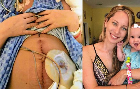 Vymodlené těhotenství provázely šílené bolesti. Lékaři nepoznali rakovinu!
