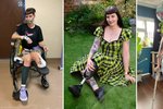 Britka Laura Armstrongová si kvůli onemocnění kostí a rakovině nechala amputovat levou nohu. Přesto se z ní stala úspěšná modelka.