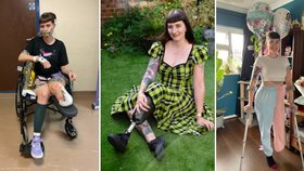 Britka Laura Armstrongová si kvůli onemocnění kostí a rakovině nechala amputovat levou nohu. Přesto se z ní stala úspěšná modelka.