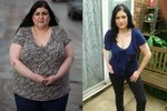 Ještě minulé léto Laura vážila pouhých 57 kilo. Teď je kvůli záhadné nemoci o víc než padesát kilo těžší.