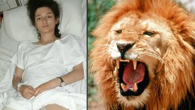 Lauren (18) lev brutálně rozdrápal nohy
