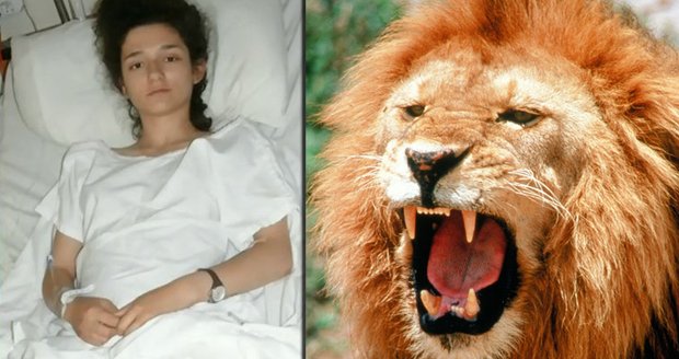 Dívka (18) se pokusila dát pusu lvovi: Šelma jí rozdrápala nohy!