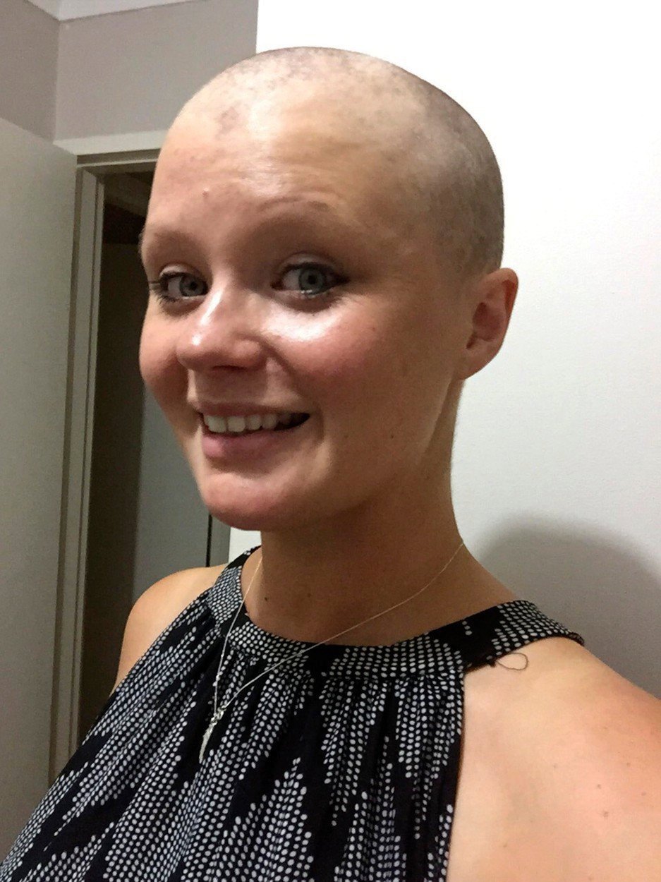 Lauren Knowles během chemoterapie.