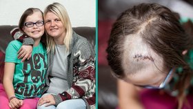 V mozku jí bujela rakovina: Pozorný optik holčičce (10) zachránil zrak i život