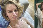 Fotografka slavných Lucie Levá (28) bojuje s rakovinou tlustého střeva.
