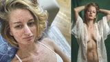 Fotografka slavných Lucie Levá (28) bojuje s rakovinou tlustého střeva: Učím se mít svoje jizvy ráda