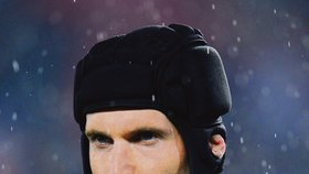 Mladík bude nosit podobnou helmu, jakou má fotbalový brankář Petr Čech