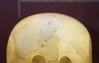 Americká lebka: V roce 1960 prý byla zakoupena v Mexiku, na veřejnosti se ale objevila až v roce 1992. Vystavena je ve washingtonském Smithsonian museum. Je největší z lebek. Váží asi 14 kilo a na výšku měří 38 cm!