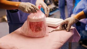 Rekordních 271 dní vydržela prasečí ledvina v lidském těle! Revoluce v medicíně?