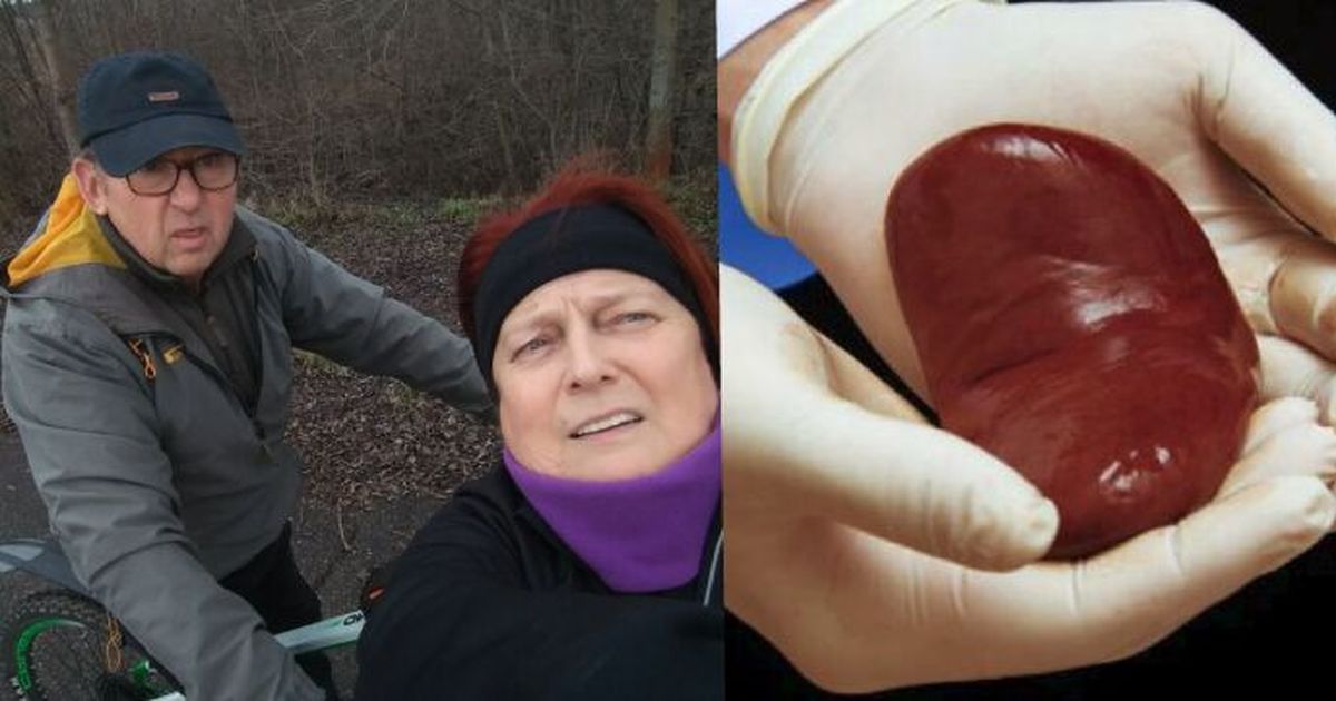 Trasplante de riñón: recibido por Otakar, luego donado nuevamente por su esposa