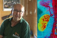 Zákeřná nemoc ledvin nebolí: Ota (65) šel na sál přímo z dílny! Co pomůže?